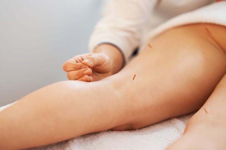 a-acupuncture-needle-therapy-in-the-studio-2023-11-27-05-20-53-utc-1.jpg